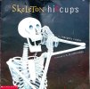 Skeleton Hiccups