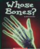 Whose bones?